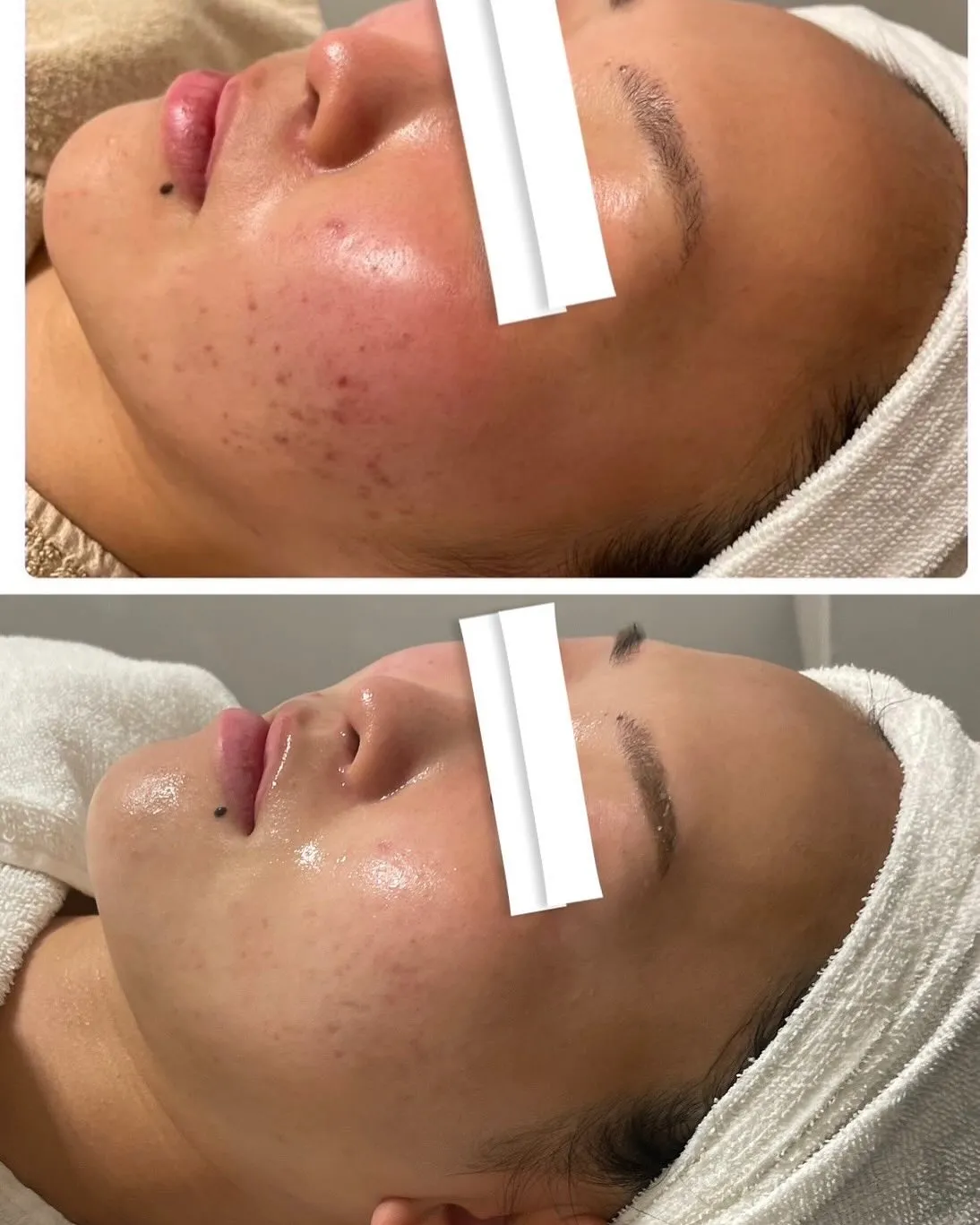 お客様のビフォーアフター💆🏼‍♀️✨