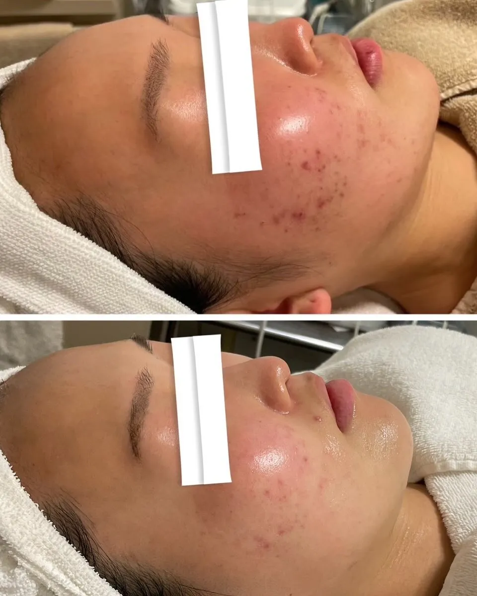 お客様のビフォーアフター💆🏼‍♀️✨
