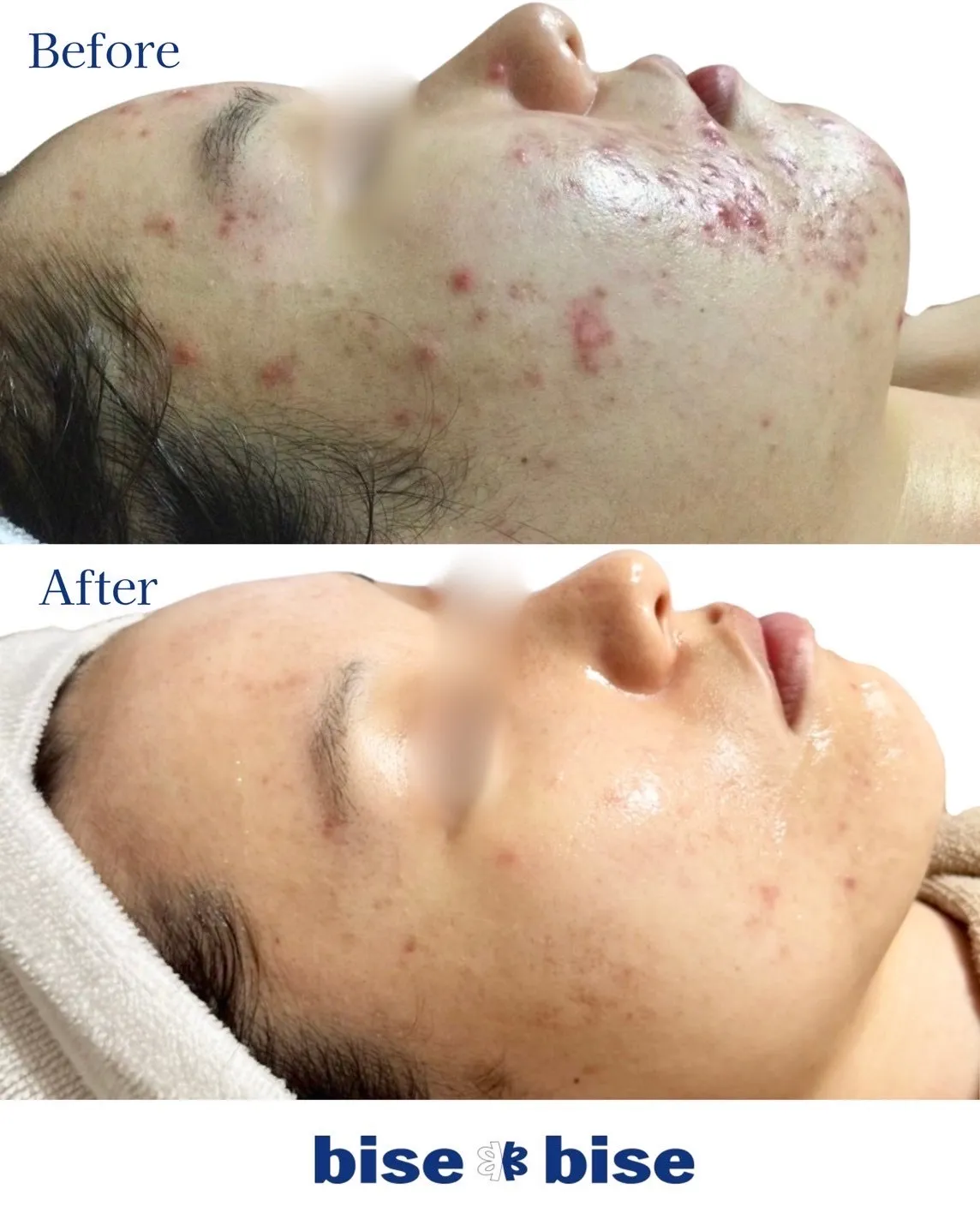 26歳