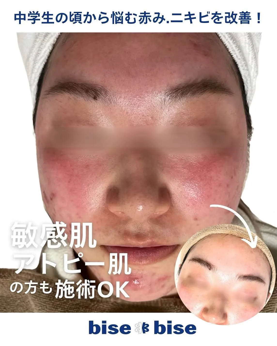 お肌のお悩みはビズビズにお任せください！