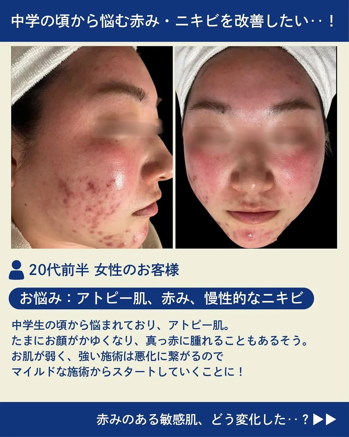 お肌のお悩みはビズビズにお任せください！