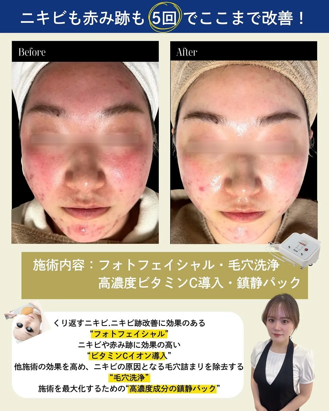 お肌のお悩みはビズビズにお任せください！
