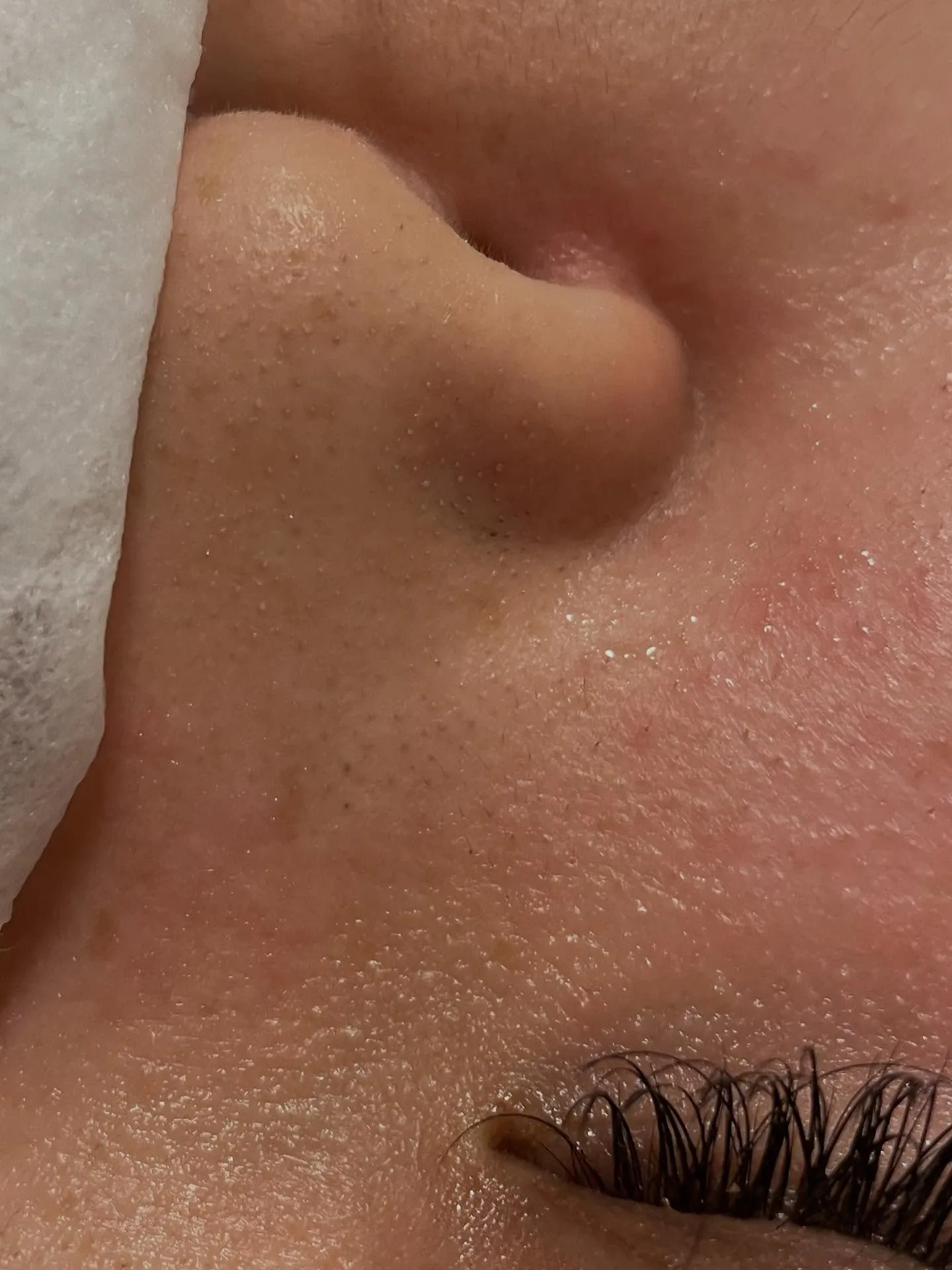 ビズビズの毛穴洗浄がバージョンアップします⤴️