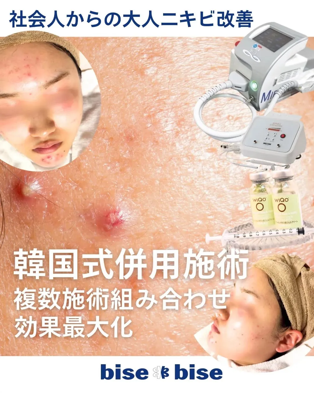 ＠nikibi₋bisebisetennoji  スキンケア...