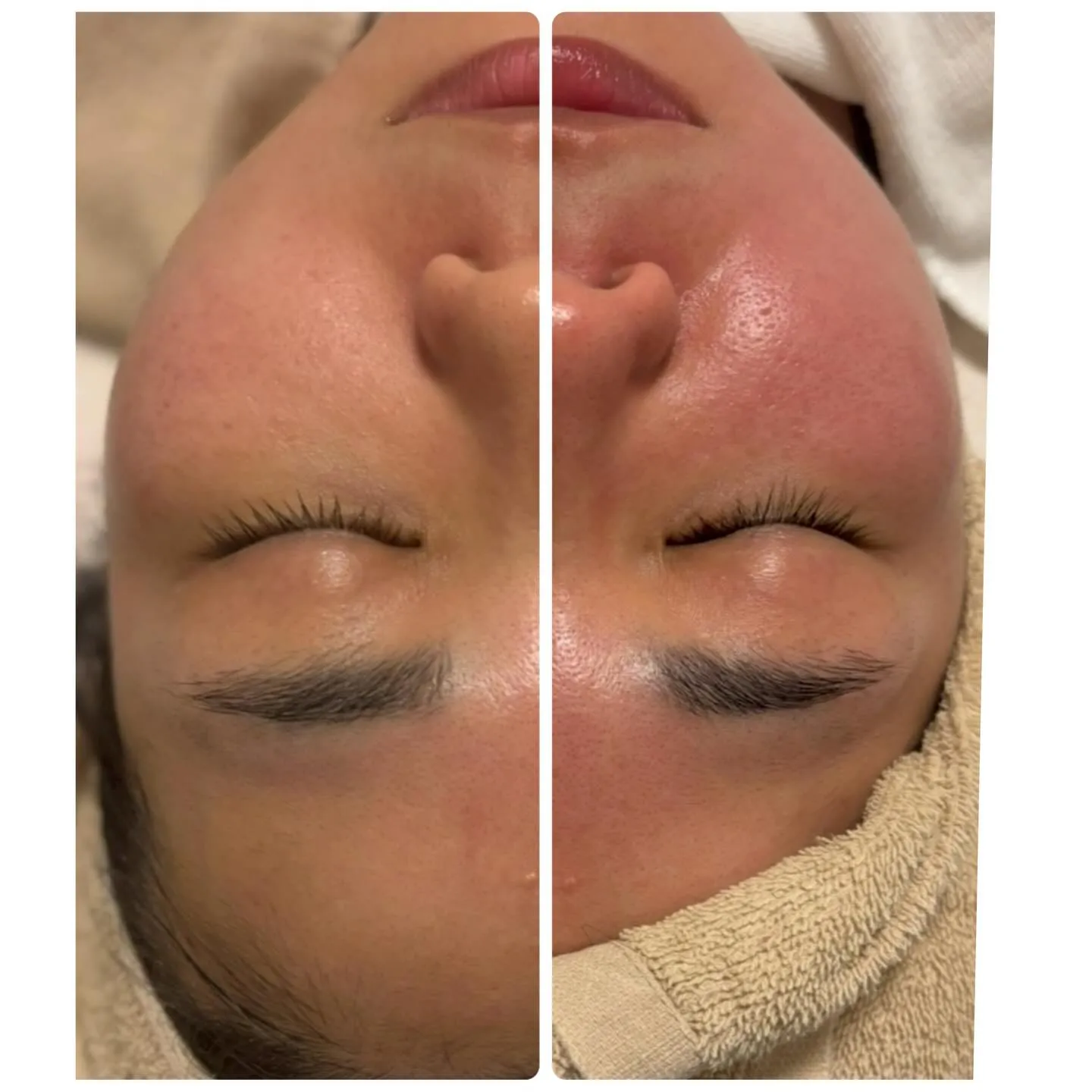 ❄️ツルツル美肌を目指しましょう❄️