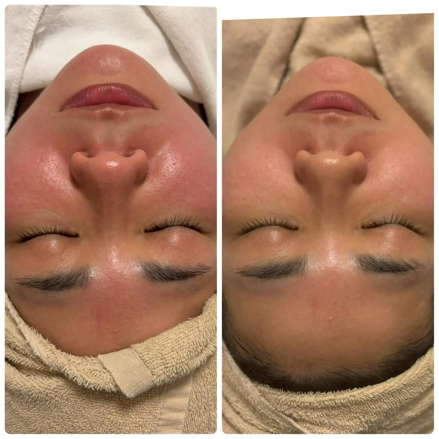 ❄️ツルツル美肌を目指しましょう❄️