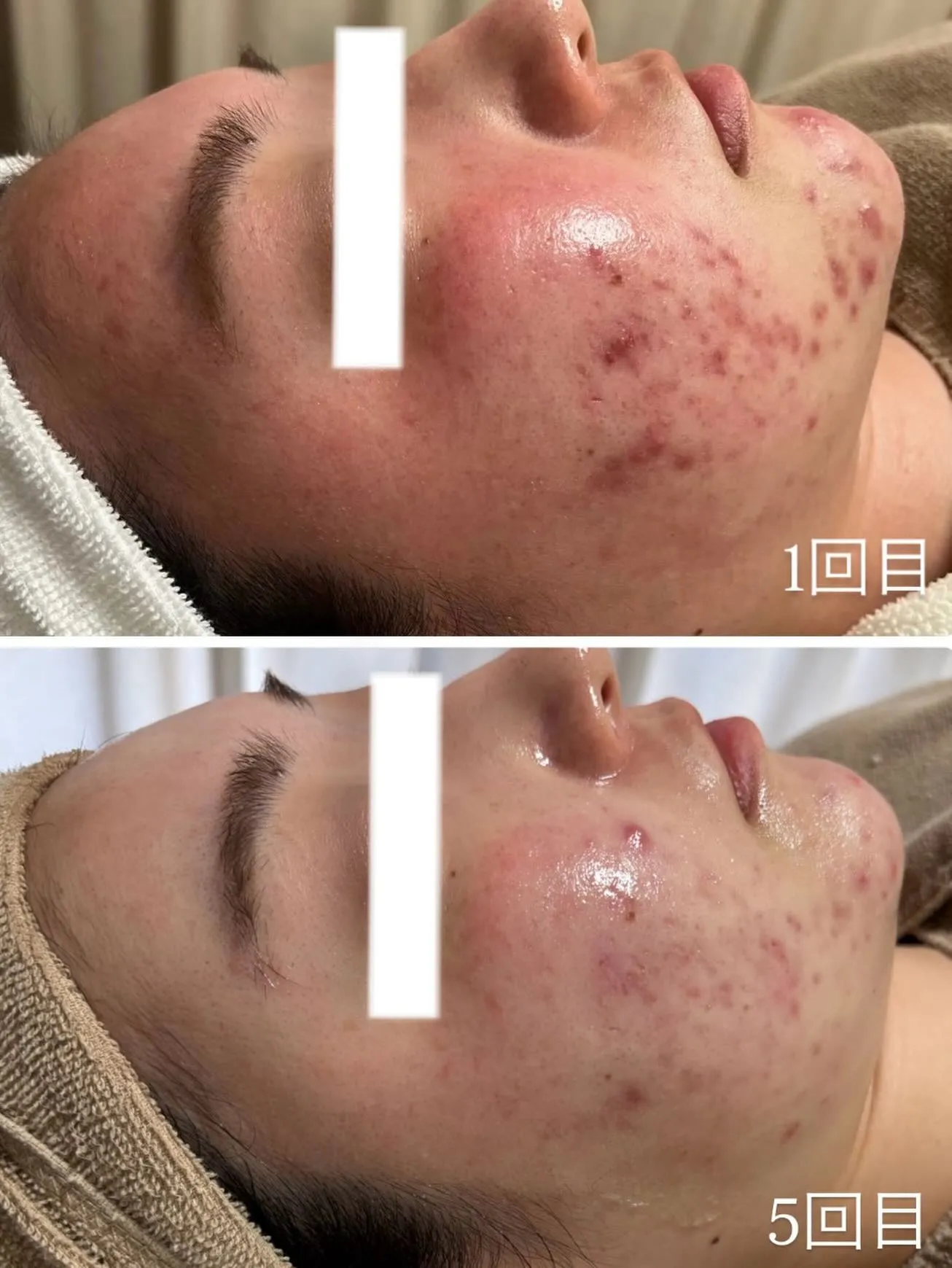 お肌のお悩みは