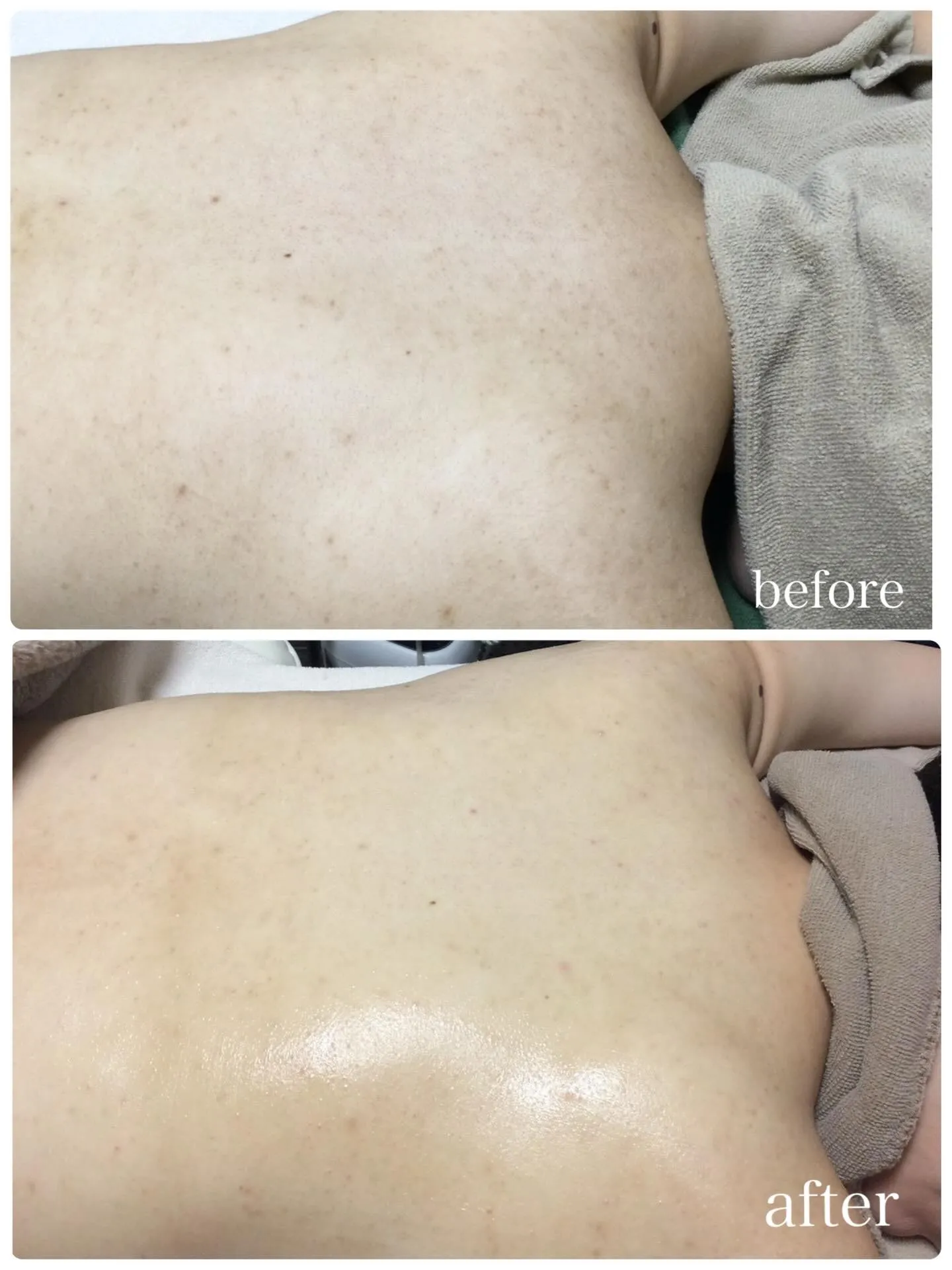 ＼鏡で背中を見たとき、