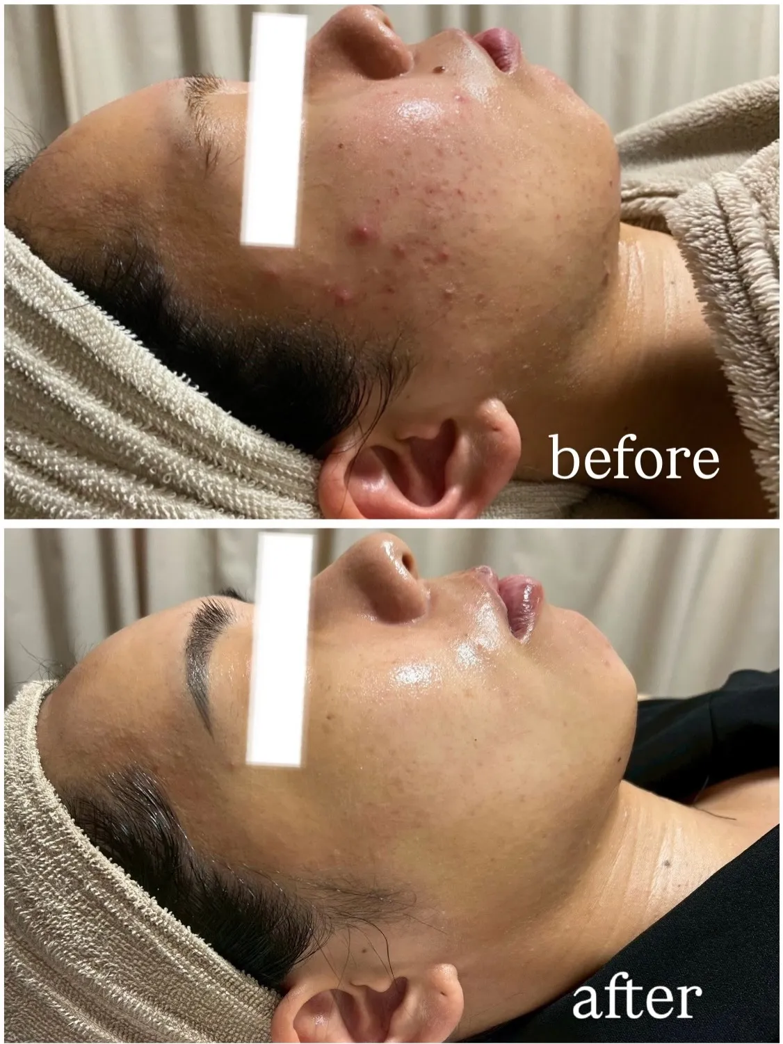 【3年越しのご来店🧖🏻‍♀️✨】