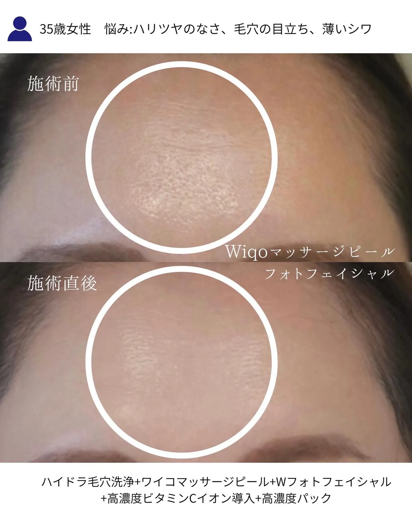 「肌を育てる」次世代エイジングケア✨