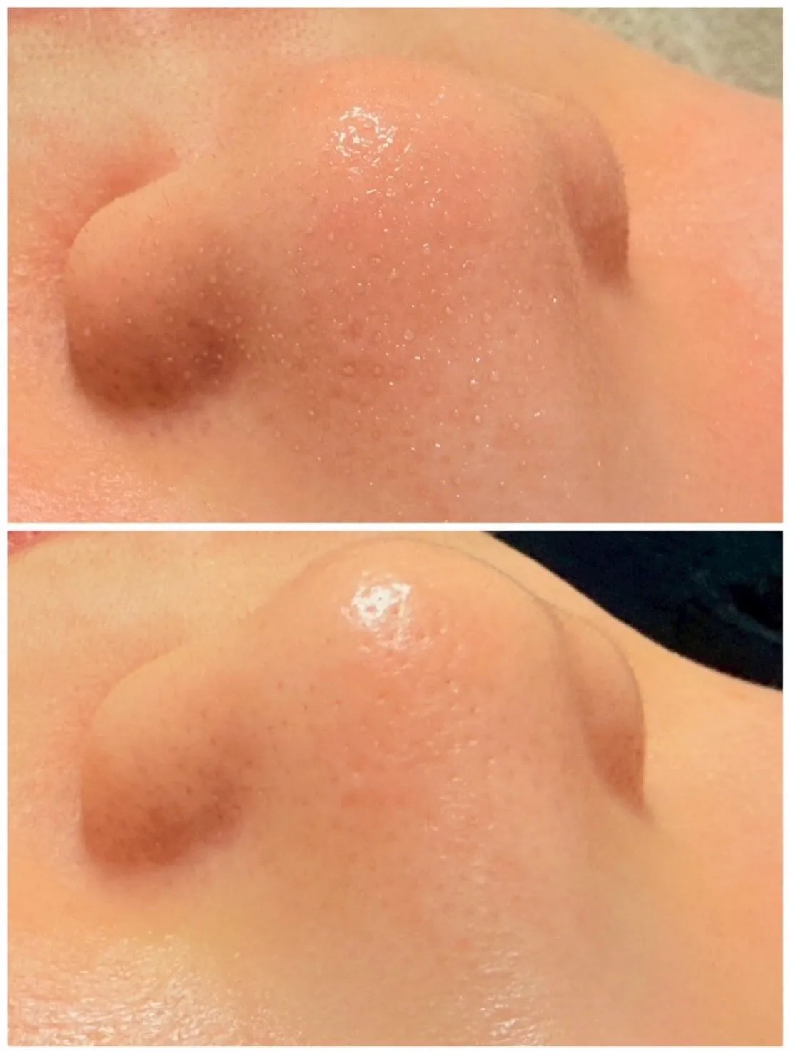 【毛穴が変わると肌はここまで変わる】