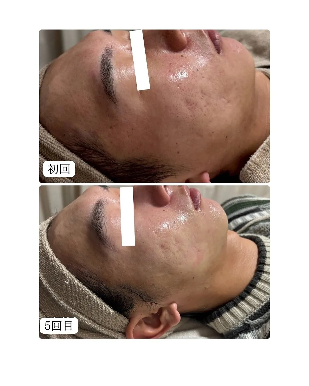 当店ではメンズの方にもご利用頂いております！