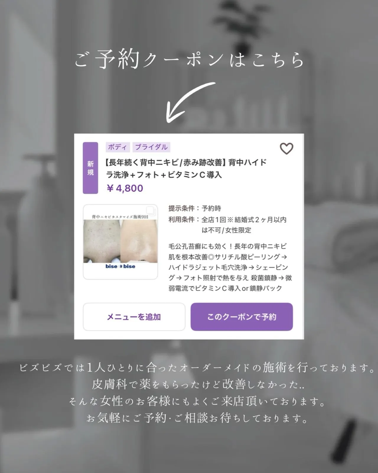 🌻今年の夏こそ美肌背中へ🌻