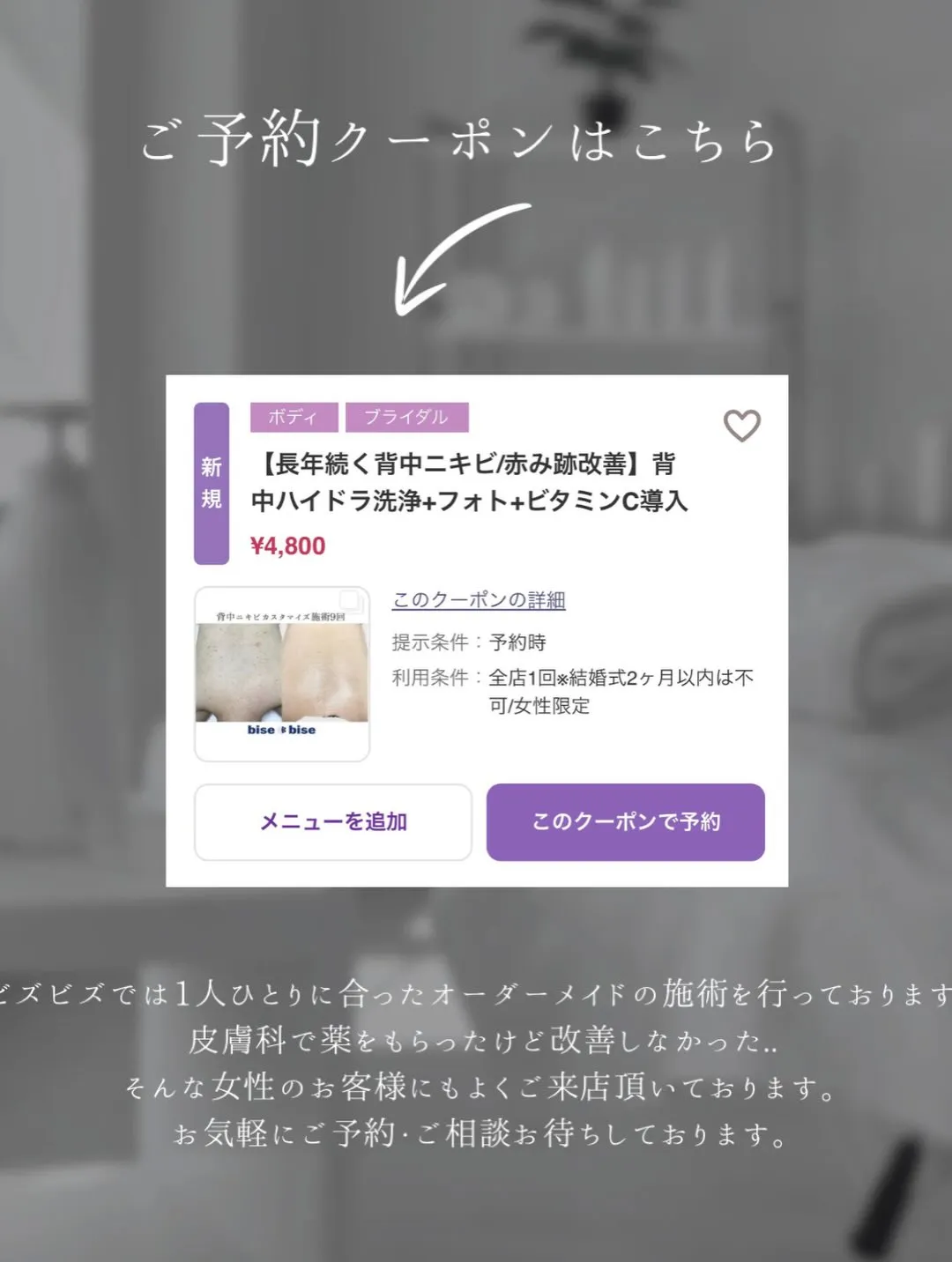 【背中フォトフェイシャル6回✨】