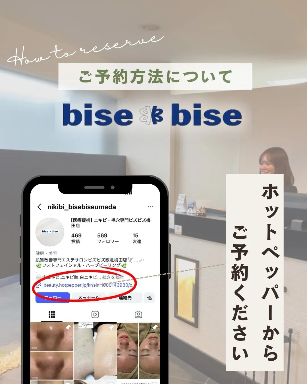 なぜニキビは治らないの?