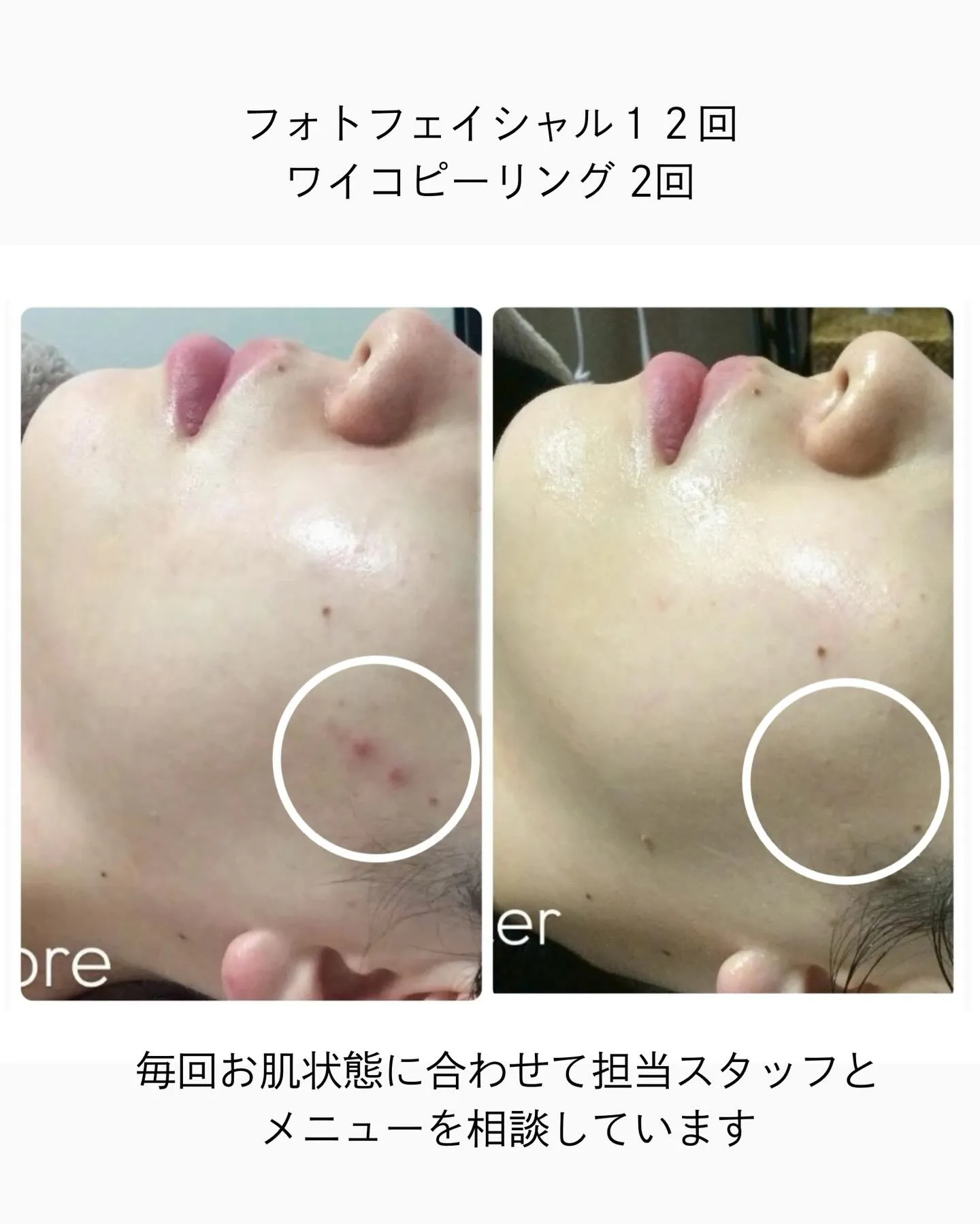 🌱一人一人に合わせたオリジナルコース🌱