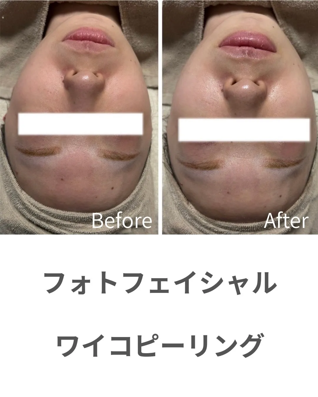 毛穴もシミもくすみも