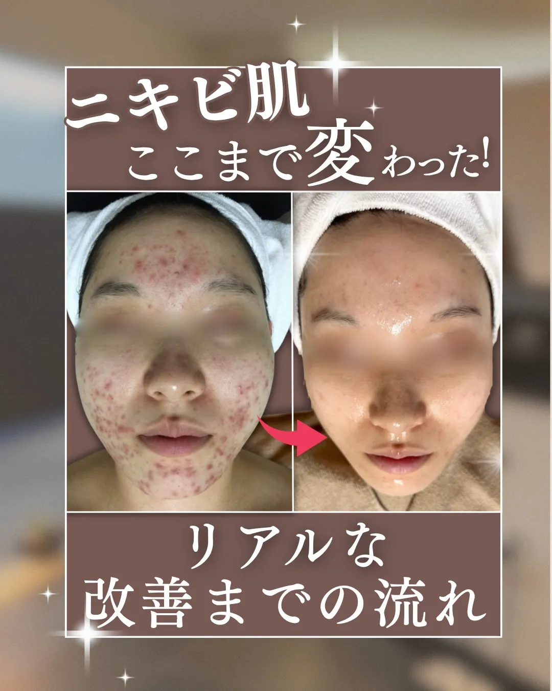 モニターでご来店いただいたお客様のビフォーアフター✨