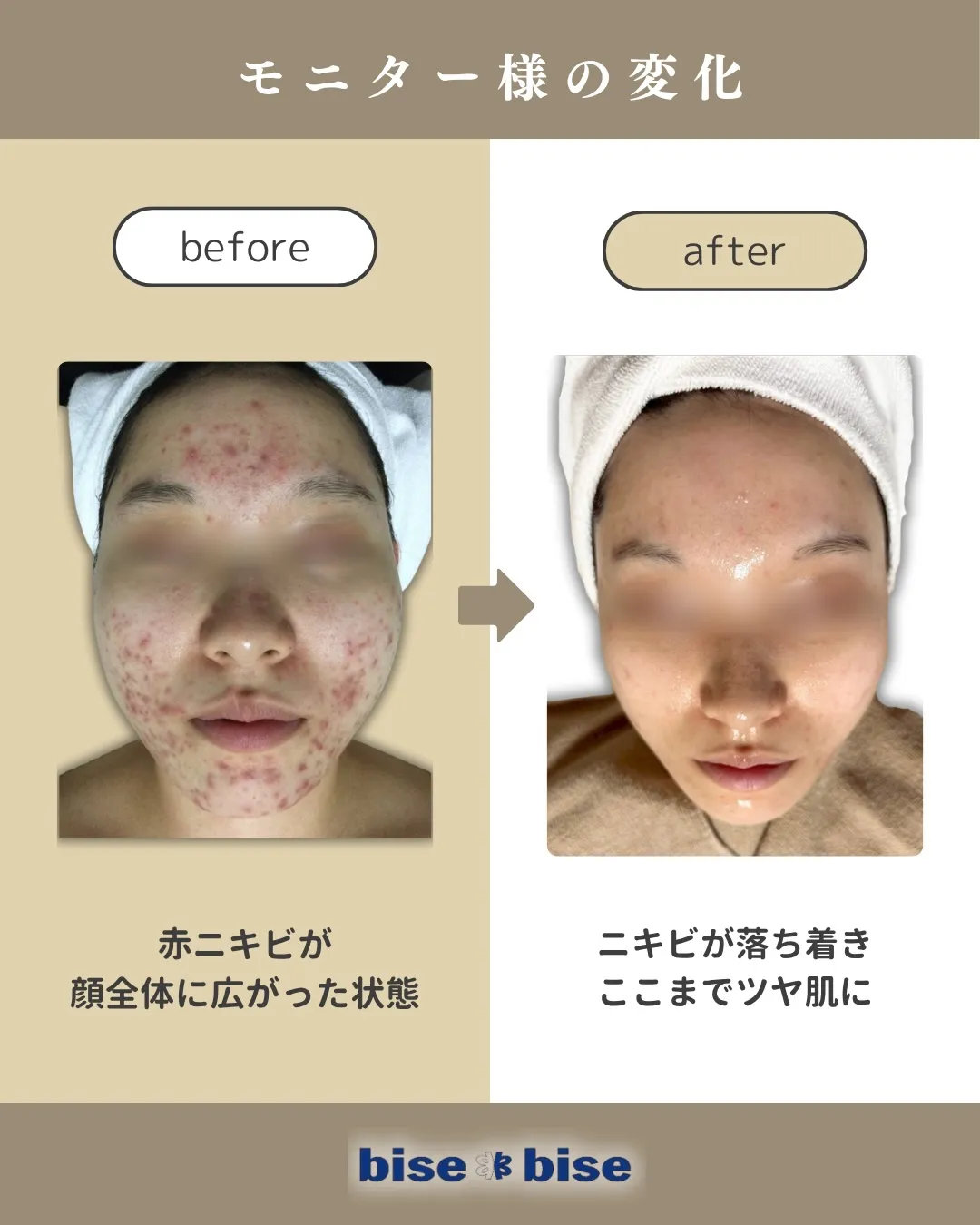 モニターでご来店いただいたお客様のビフォーアフター✨