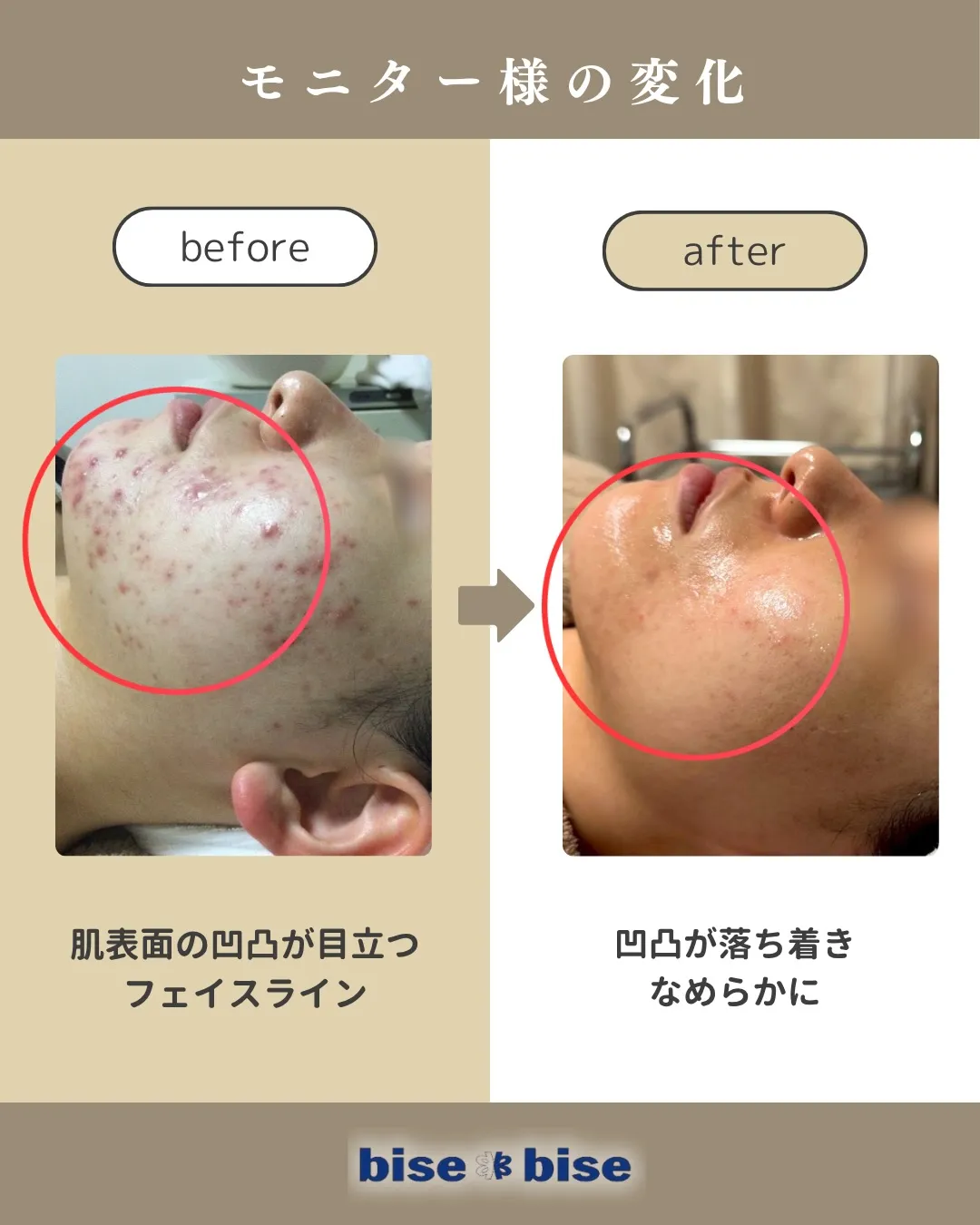 モニターでご来店いただいたお客様のビフォーアフター✨