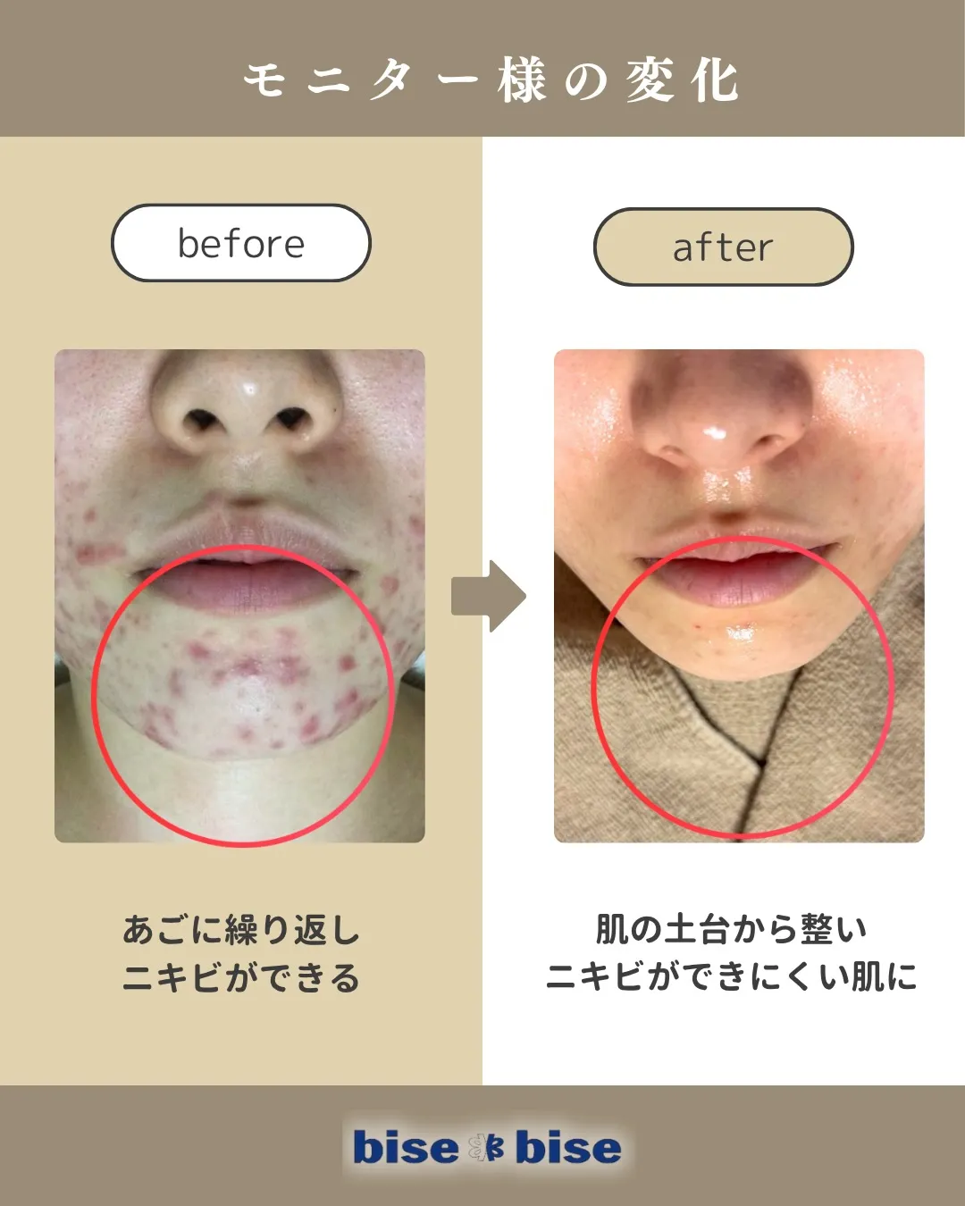 モニターでご来店いただいたお客様のビフォーアフター✨