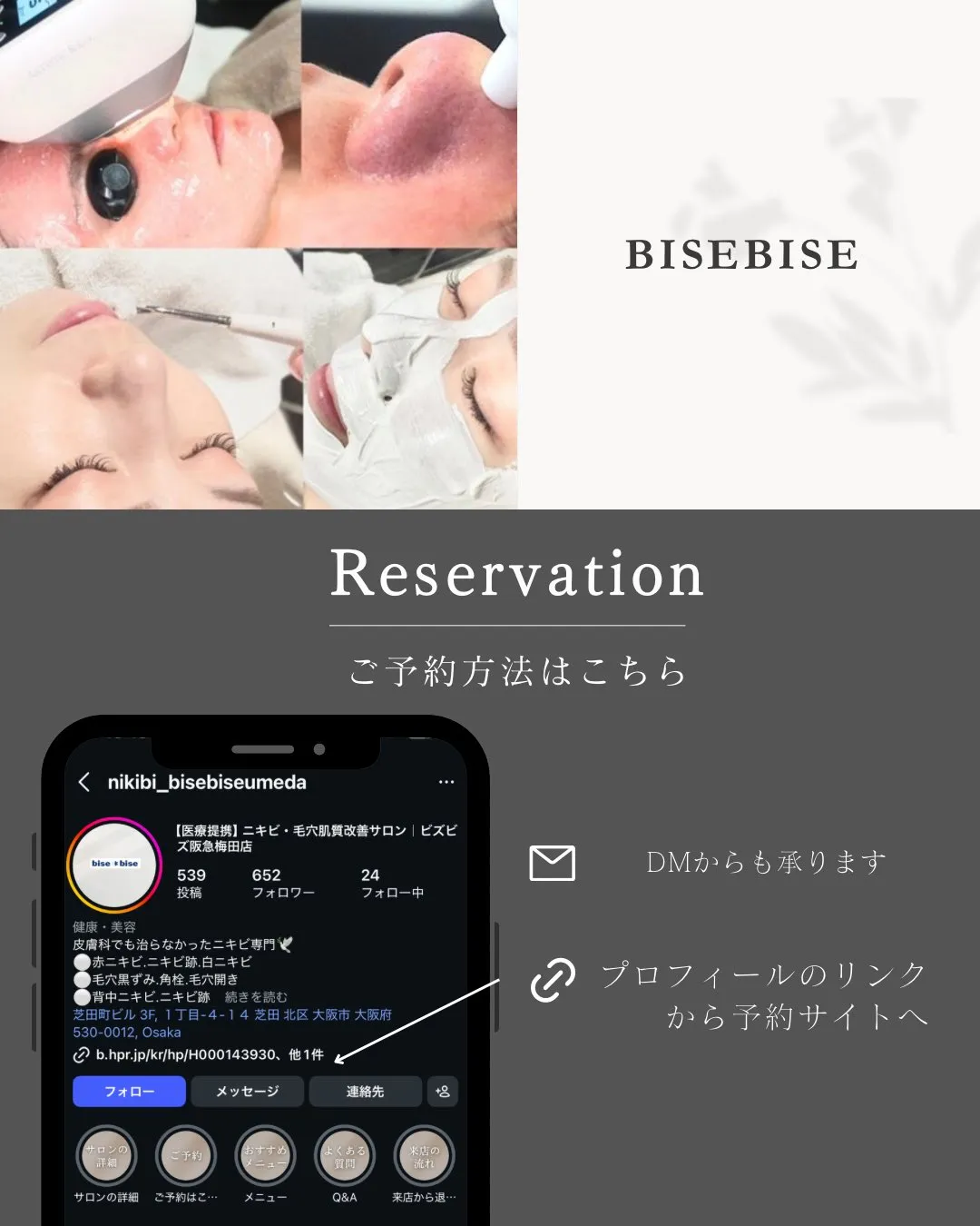 ニキビでお悩みの方必見👀！