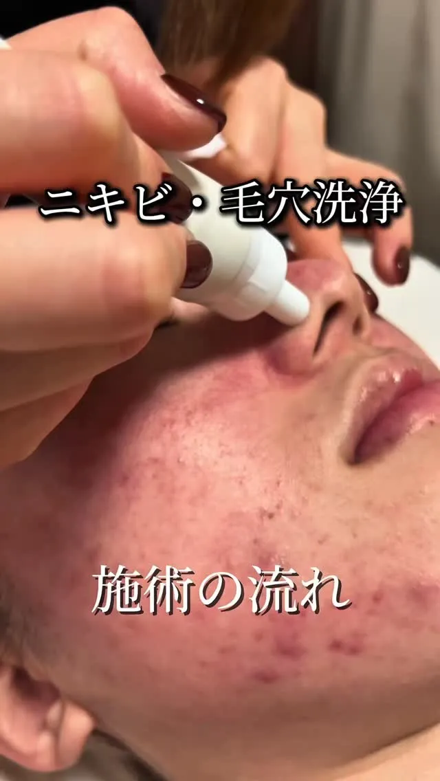 \ 春のゆらぎ肌は“今”のケアが正解🌿 /