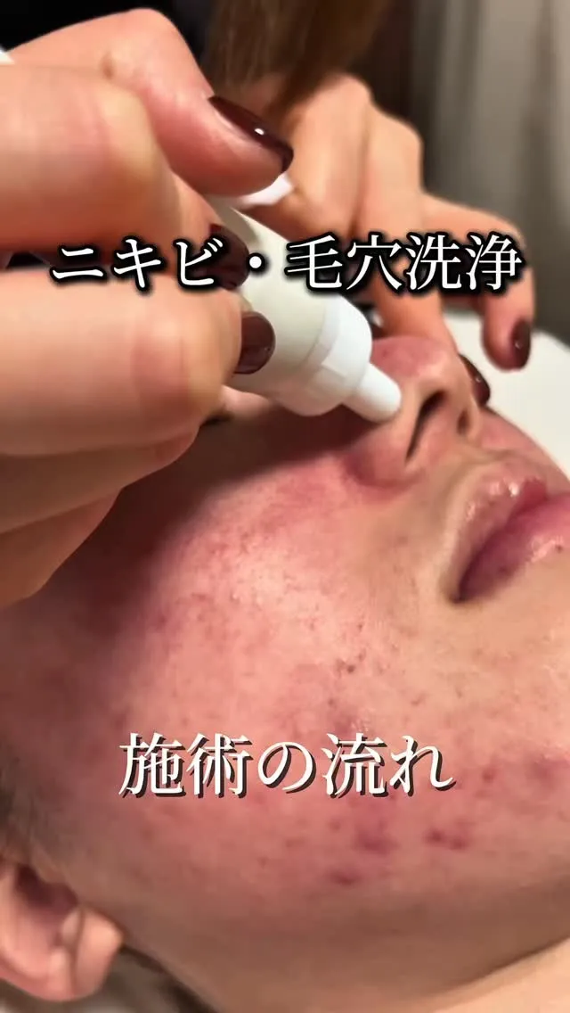 当店大人気メニュー『フォトフェイシャル』❕✨