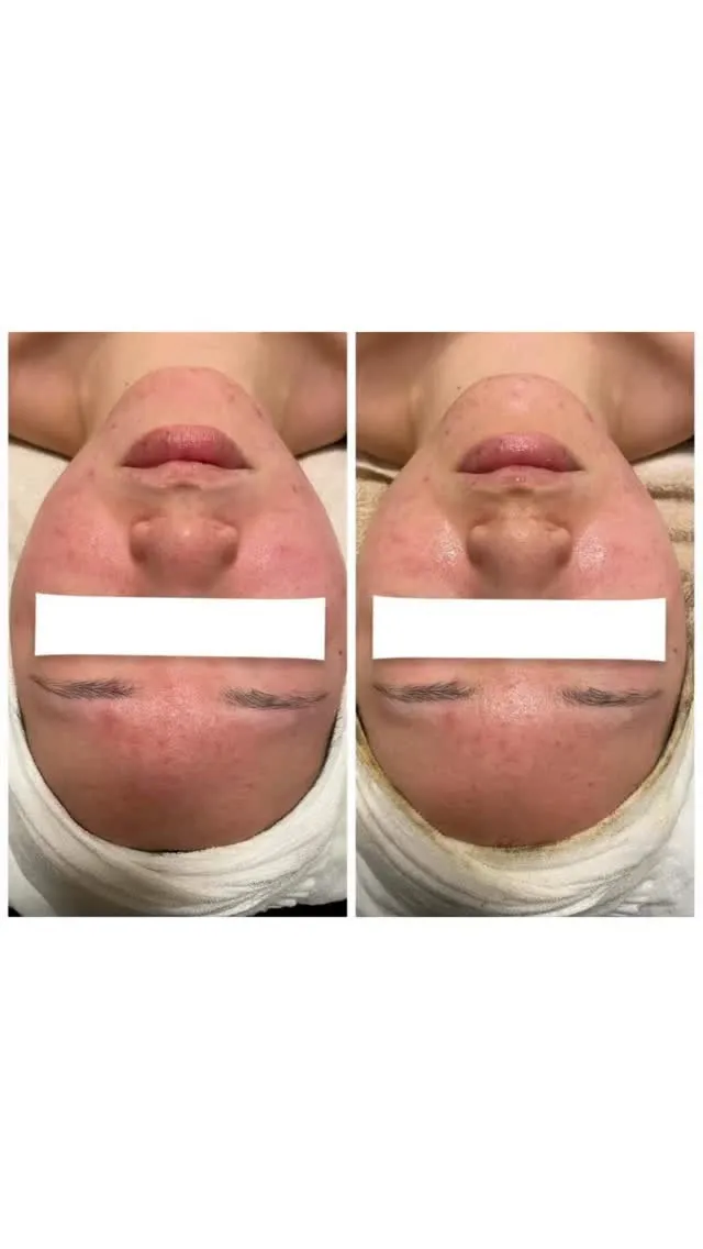 【削らない、剥かない、育てるハーブ】